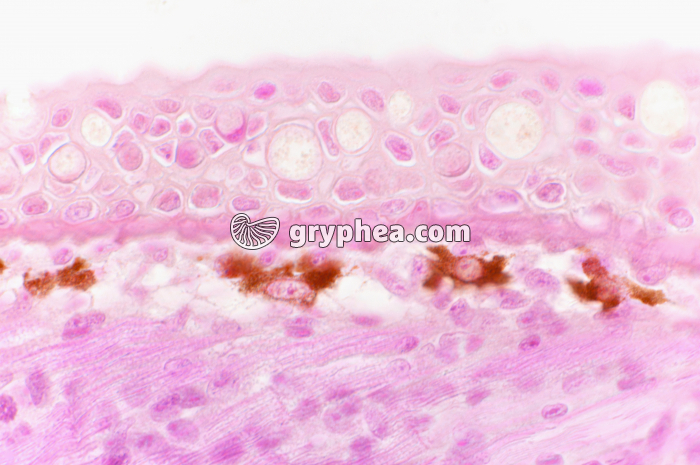 Mélanocytes de Poisson x200 - gryphea.org